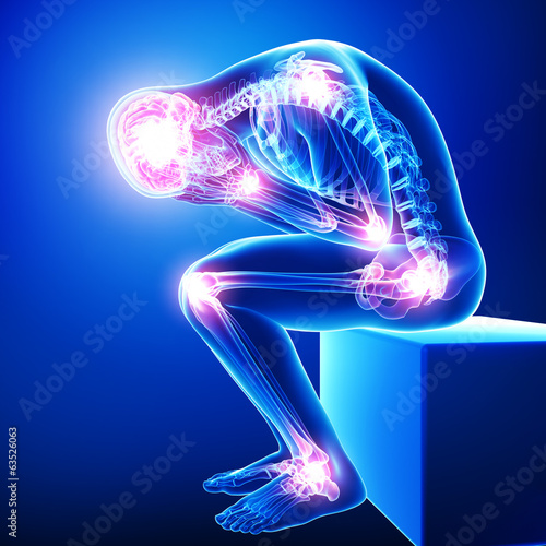 Anatomy of male brain pain with all joints pain in blue photo