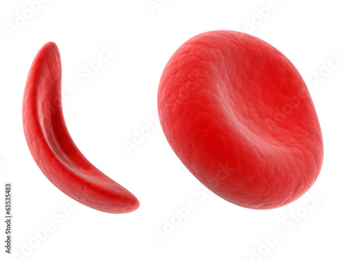 scientific illustration - sickle cell blood cell photo