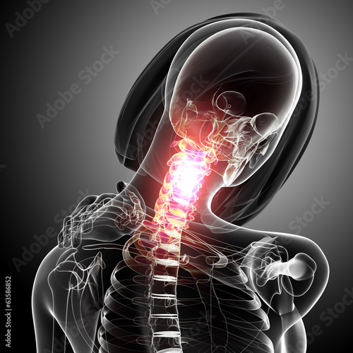 Anatomy of female neck pain in gray