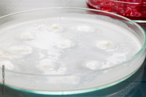 Growing Bacteria in Petri Dishes