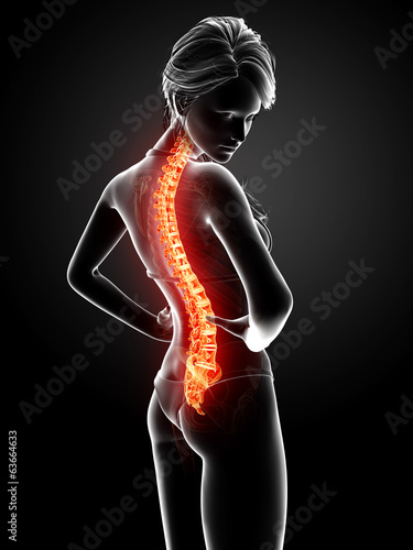 Anatomy of female back pain in black