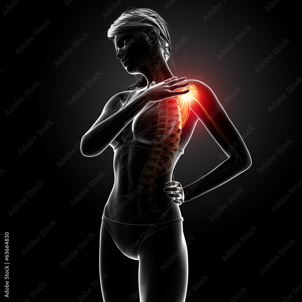 3d Anatomy of female shoulder pain in black