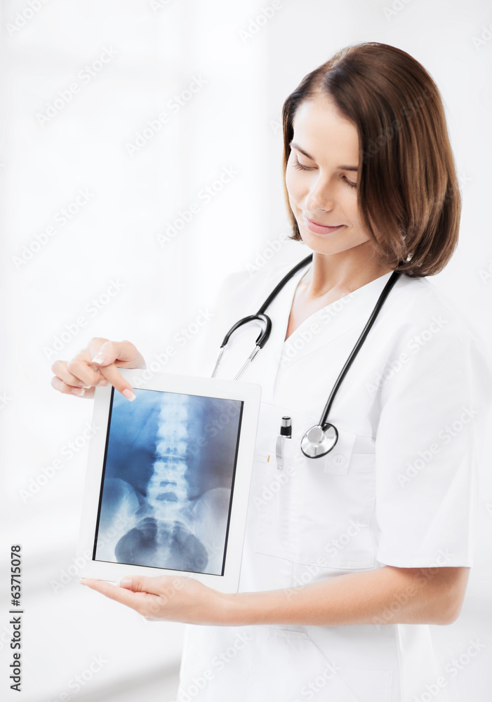 female doctor with x-ray on tablet pc female doctor with x-ray on tablet pc