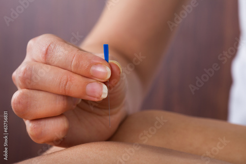 Therapist Performing Acupuncture Treatment