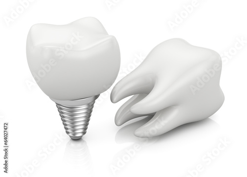 Tooth and dental implant