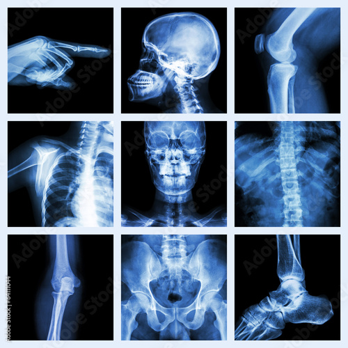 Collection X-ray part of human