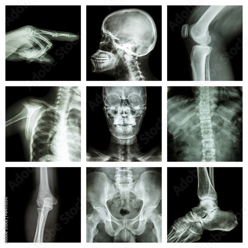 Collection X-ray part of human