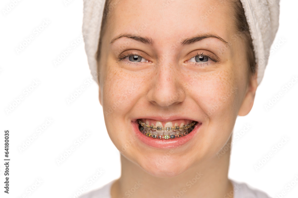 Cheerful girl with braces isolated Cheerful girl with braces isolated