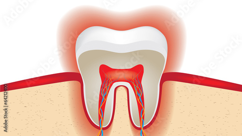 pulsation of sensitive tooth enamel