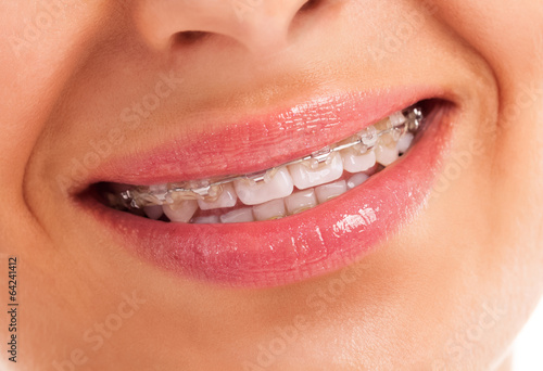 Details of teeth
