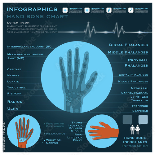 Hand Bone Infographic Infocharts Health And Medical