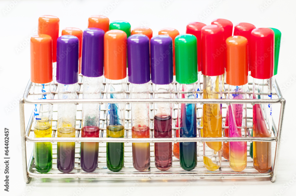 test tubes in laboratory - identify bacteria test tubes in laboratory - identify bacteria