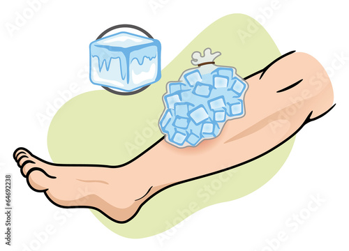 First Aid ice pack on the leg