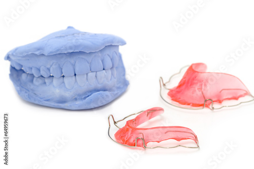 dental gypsum models and dental brace (Retainer) photo