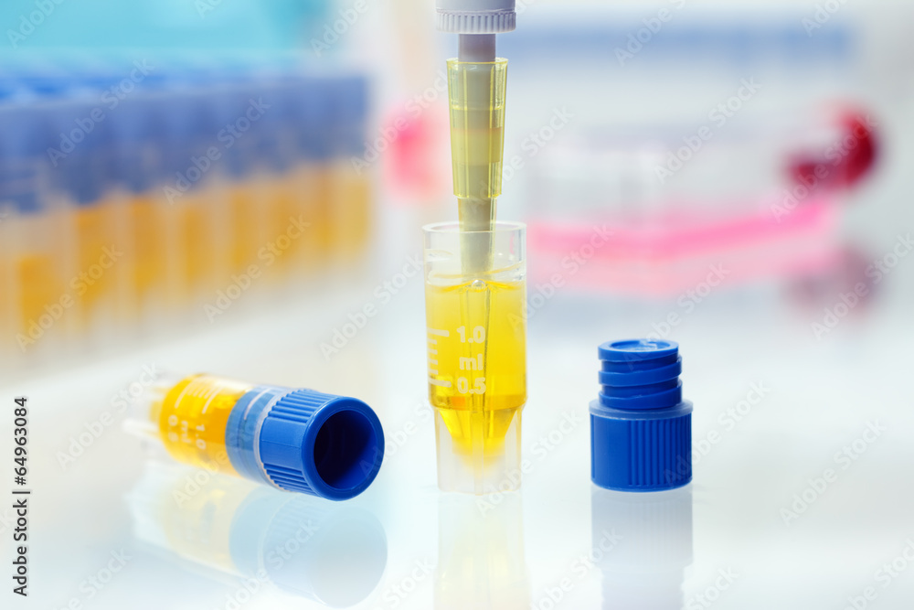 PCR samples in microtubes PCR samples in microtubes