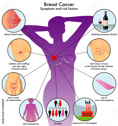 sintomi e fattori di rischio del cancro al seno photo