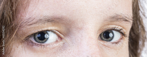 Close up of teens eyes photo