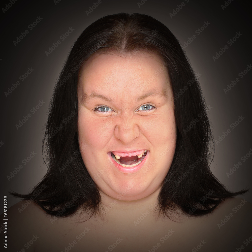 Portrait an ugly woman with missing teeth. Stock Photo