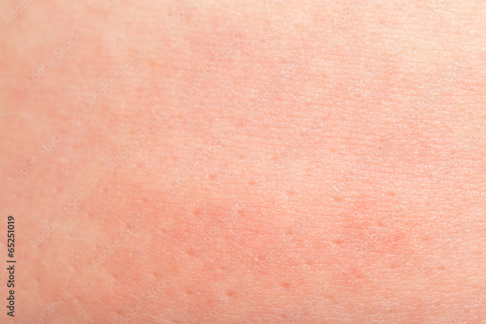 human skin as background human skin as background