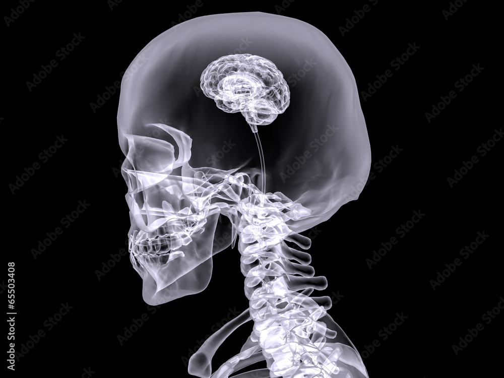 spacer.png
