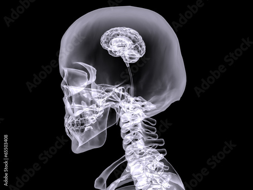 Fotótapéta X-ray small brain #2