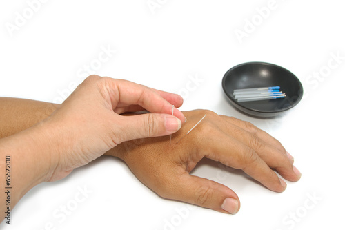 Wallpaper Mural Hand applying acupuncture needle, Alternative medical Torontodigital.ca