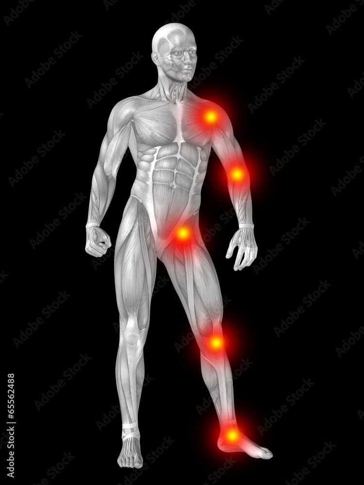 3D human man anatomy with articular pain 3D human man anatomy with articular pain