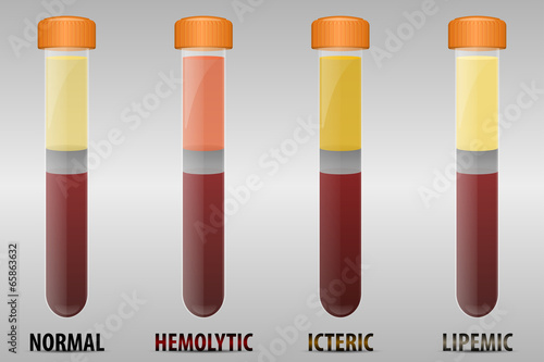 Blood serum common types