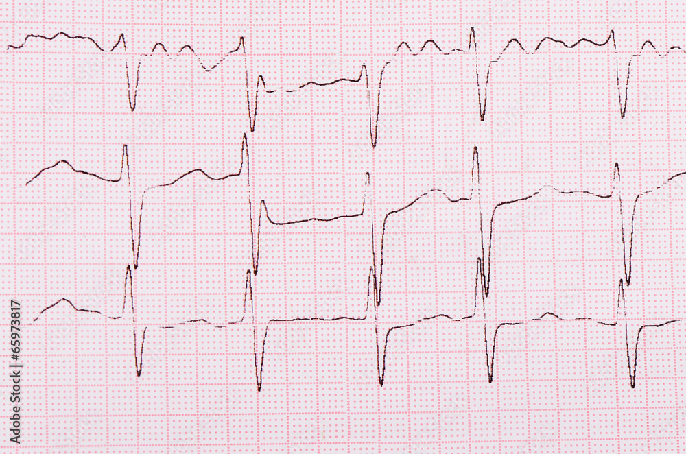 The tape with the cardiogram of a man The tape with the cardiogram of a man