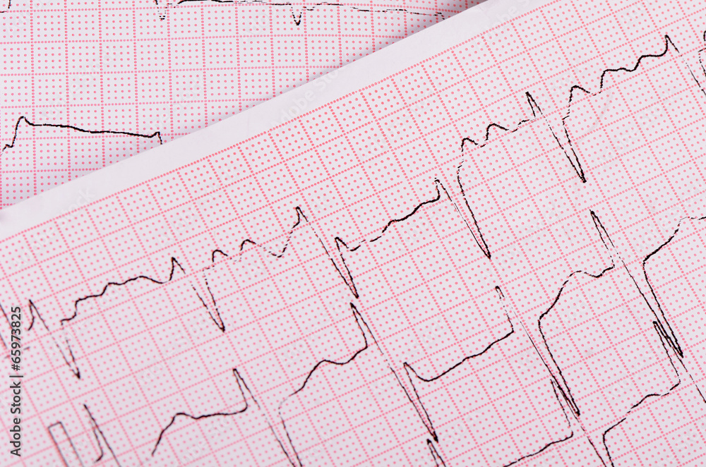 The tape with the cardiogram of a man The tape with the cardiogram of a man