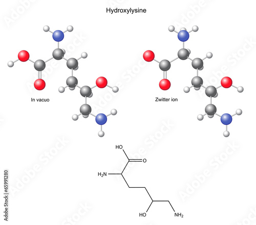 Hydroxylysine (Hyl) - chemical structural formula and models