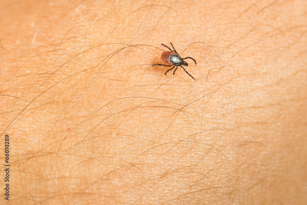 Tick - parasitic arachnid blood-sucking Tick - parasitic arachnid blood-sucking