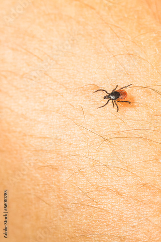 Tick - parasitic arachnid blood-sucking