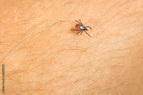 Tablou canvas Tick - parasitic arachnid blood-sucking