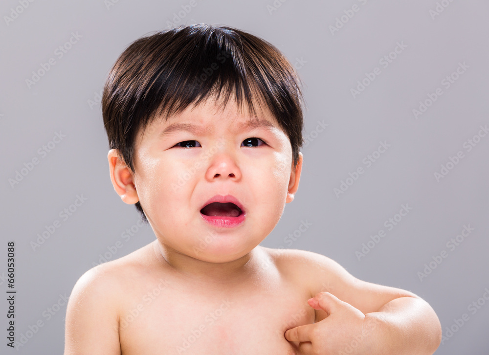 Baby with skin problem