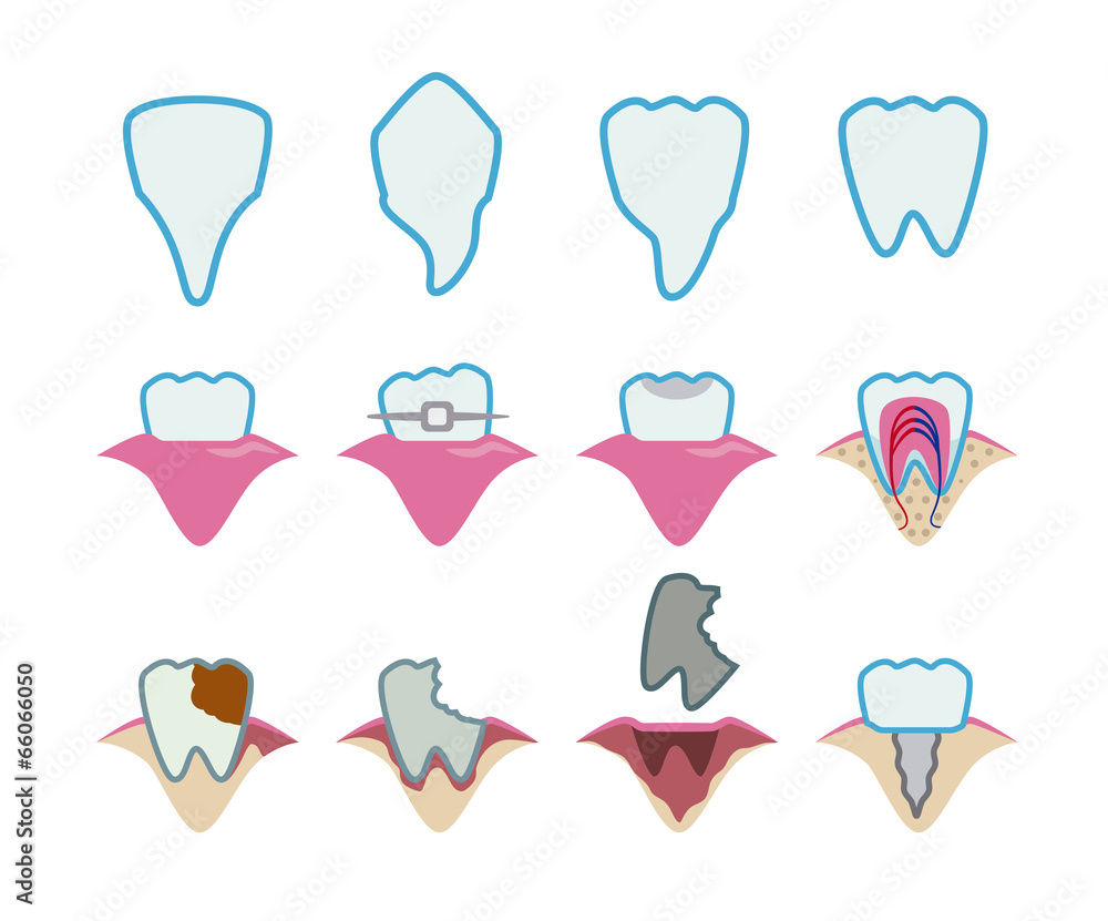 Dental design Dental design