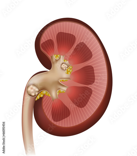 Kidney stones. Detailed anatomy illustration of the kidney