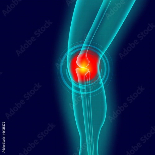 Kneee pain