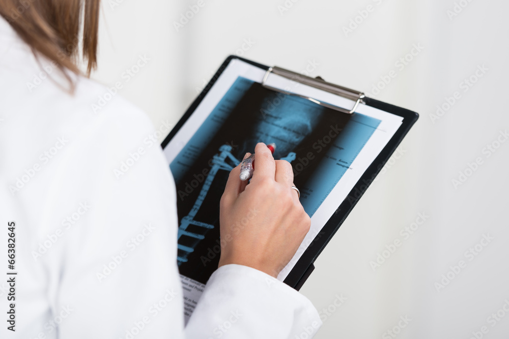 ärztin schaut auf röntgenbild