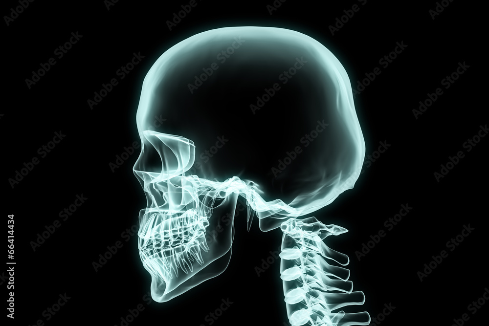 X-ray head and neck