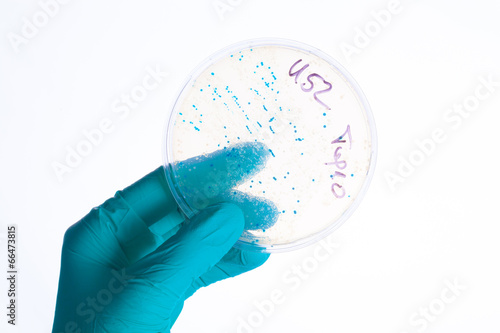 Petri dishes in the laboratory hand