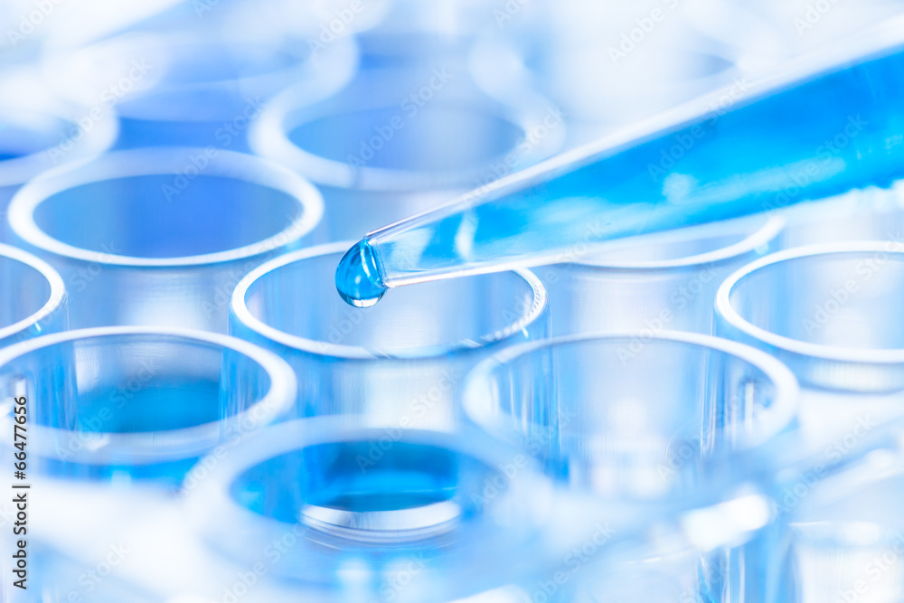 pipette and test tube in a laboratory pipette and test tube in a laboratory