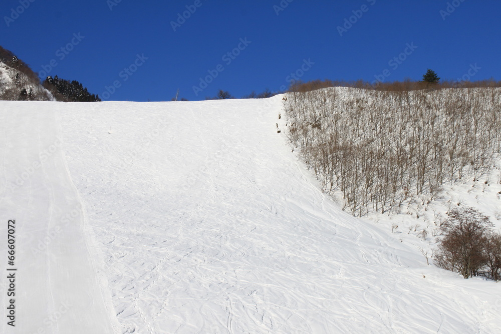 Fototapeta premium スキー場
