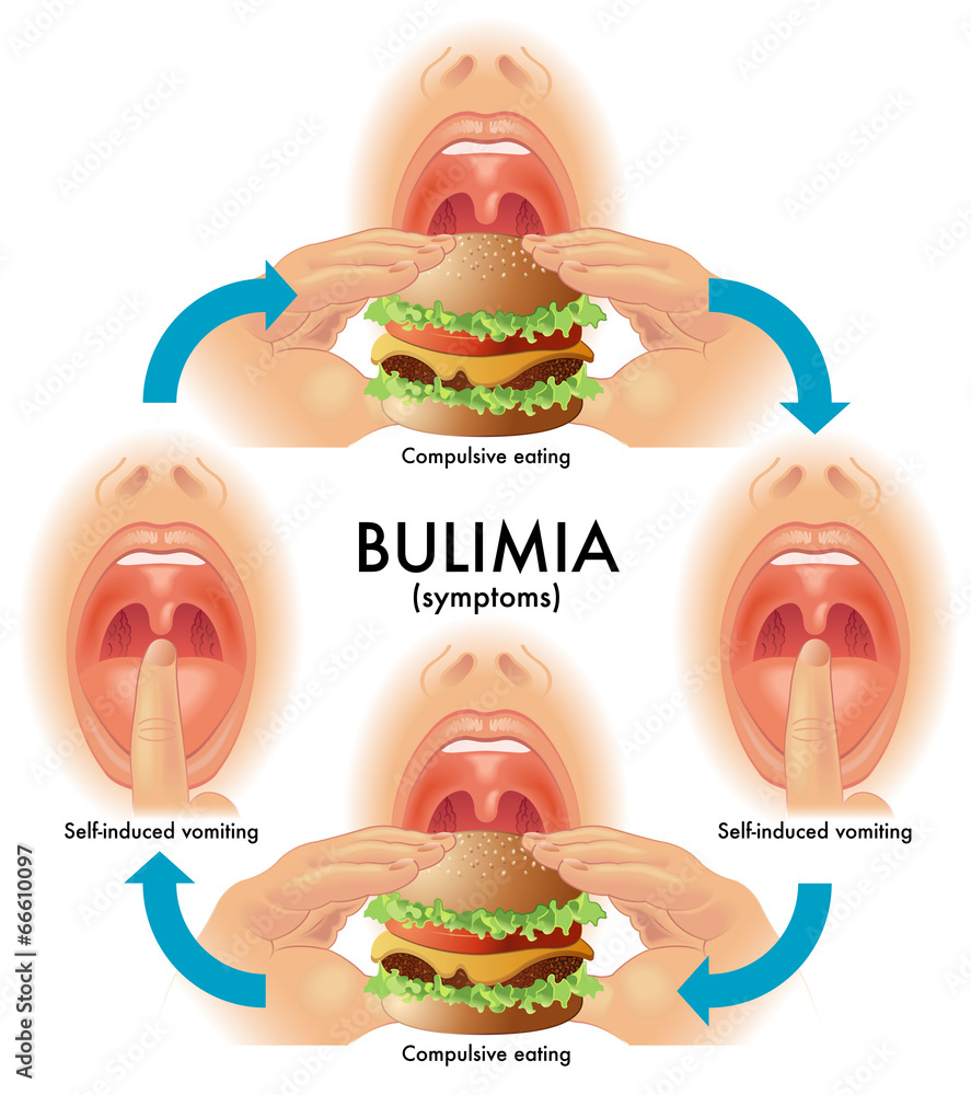 Fotografie bulimia