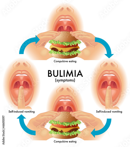 bulimia photo