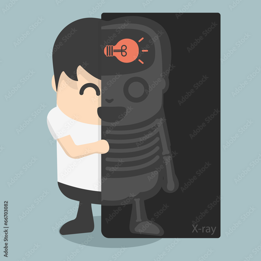 X-ray machine found the lamp in the brain of businessman X-ray machine found the lamp in the brain of businessman