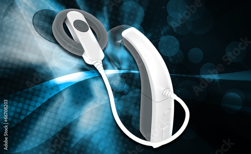 Cochlear Implant