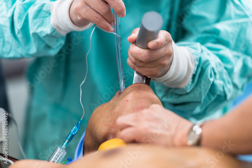 insertion endotracheal tube photo