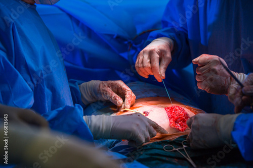 Surgery in a modern hospital being performed by a team