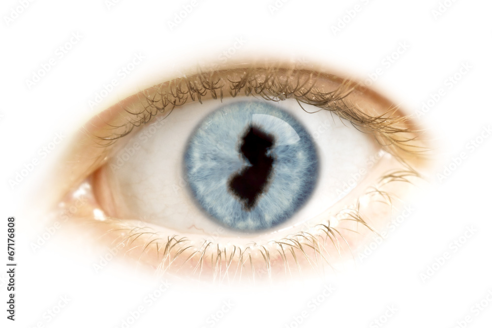 Close-up of an eye with the pupil in the shape of New Jersey.(se Close-up of an eye with the pupil in the shape of New Jersey.(se